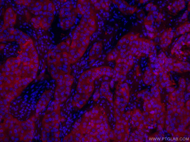 PADI2 Antibody in Immunohistochemistry (PFA fixed) (IHC (PFA))