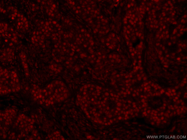 GATA3 Antibody in Immunohistochemistry (PFA fixed) (IHC (PFA))