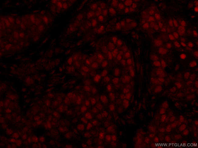 GATA3 Antibody in Immunohistochemistry (PFA fixed) (IHC (PFA))