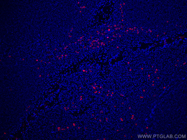 Heavy chain of IgG4 Antibody in Immunohistochemistry (PFA fixed) (IHC (PFA))