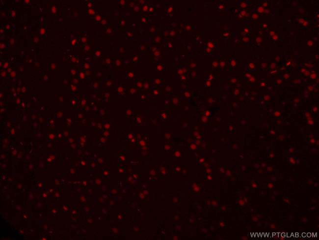 SOX2 Antibody in Immunohistochemistry (PFA fixed) (IHC (PFA))