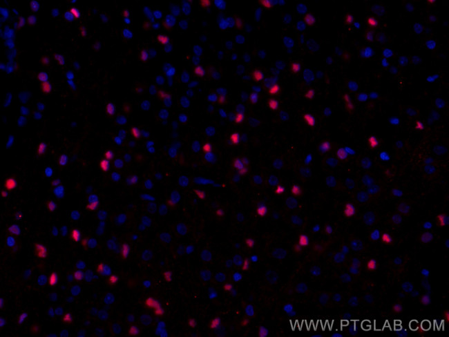 SOX2 Antibody in Immunohistochemistry (PFA fixed) (IHC (PFA))