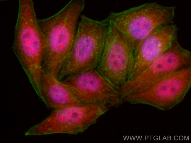 STAT5B Antibody in Immunocytochemistry (ICC/IF)