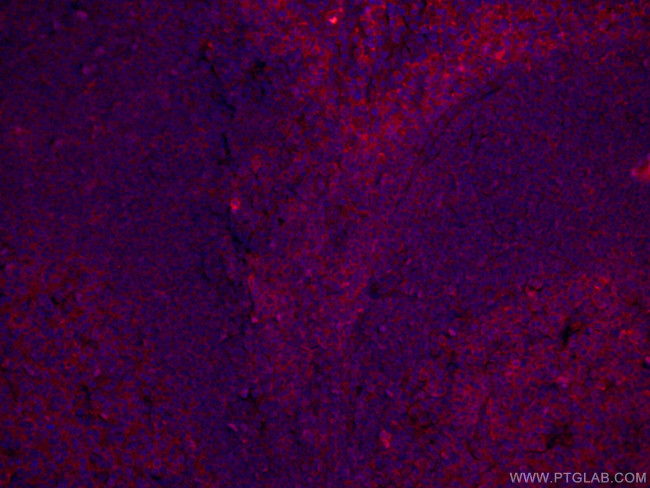 CD147 Antibody in Immunohistochemistry (PFA fixed) (IHC (PFA))