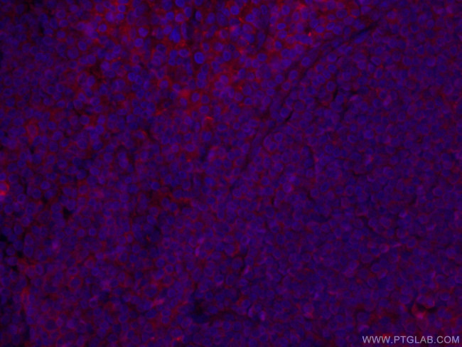 CD147 Antibody in Immunohistochemistry (PFA fixed) (IHC (PFA))