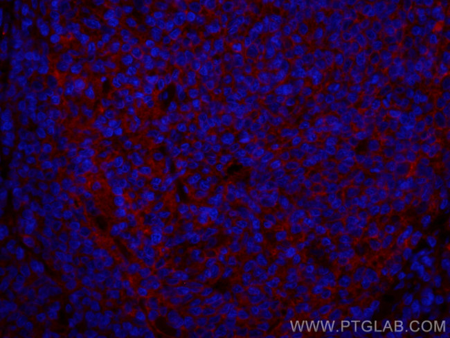 CD147 Antibody in Immunohistochemistry (PFA fixed) (IHC (PFA))