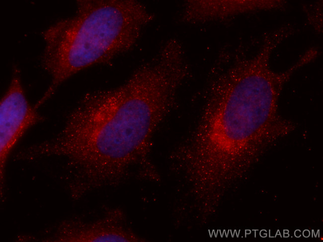 ADRM1 Antibody in Immunocytochemistry (ICC/IF)