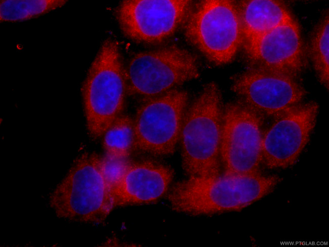 SLP76 Antibody in Immunocytochemistry (ICC/IF)