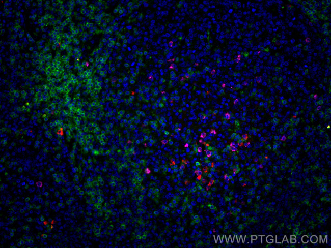 IGHM Antibody in Immunohistochemistry (PFA fixed) (IHC (PFA))