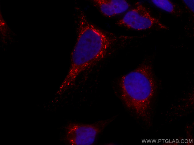 PYCR1 Antibody in Immunocytochemistry (ICC/IF)