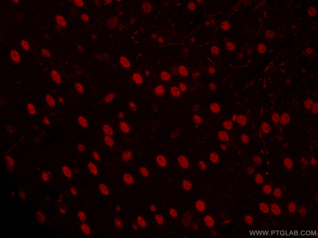 TBR1 Antibody in Immunohistochemistry (PFA fixed) (IHC (PFA))