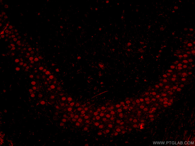 TBR1 Antibody in Immunohistochemistry (PFA fixed) (IHC (PFA))