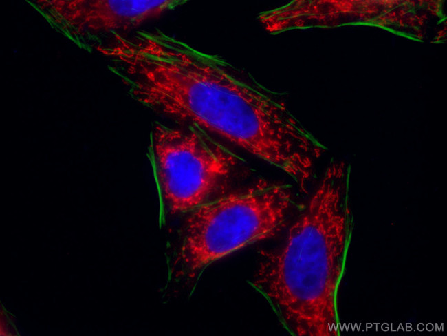 SDHA Antibody in Immunocytochemistry (ICC/IF)