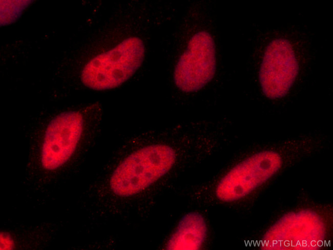 KU70/XRCC6 Antibody in Immunocytochemistry (ICC/IF)