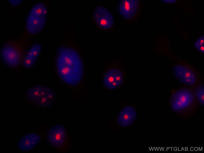 DDX54 Antibody in Immunocytochemistry (ICC/IF)