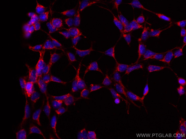 RAB3GAP1 Antibody in Immunocytochemistry (ICC/IF)