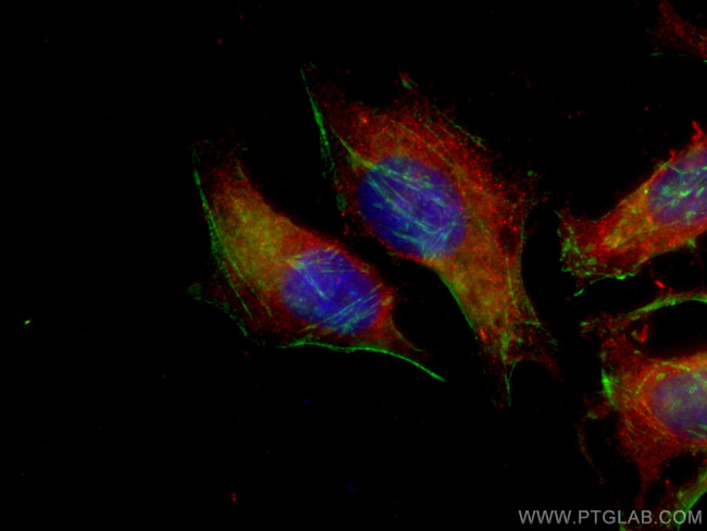 TNFAIP3 Antibody in Immunocytochemistry (ICC/IF)