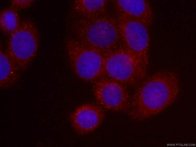 TNFAIP3 Antibody in Immunocytochemistry (ICC/IF)