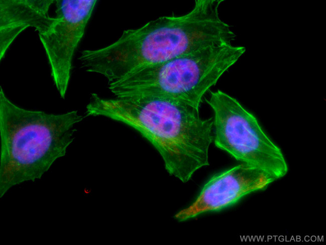 ARNT,HIF1B Antibody in Immunocytochemistry (ICC/IF)