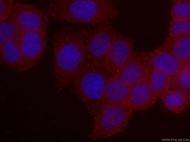 RHOA Antibody in Immunocytochemistry (ICC/IF)