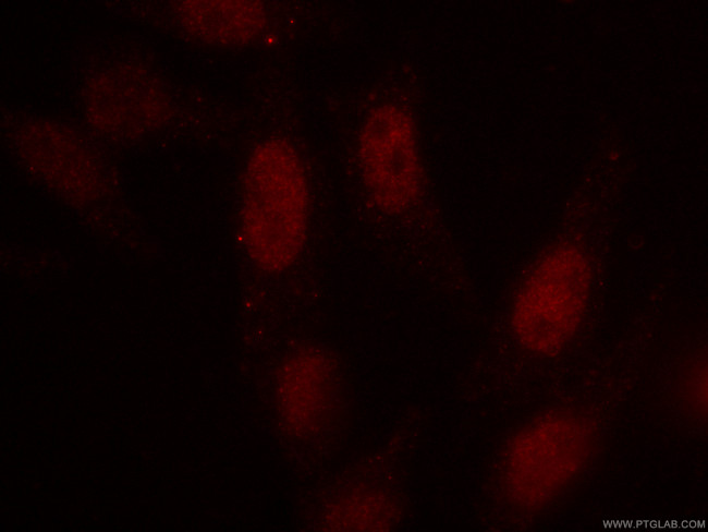 SRF Antibody in Immunocytochemistry (ICC/IF)