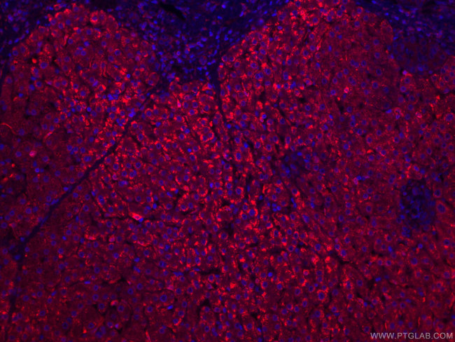 HO-1/HMOX1 Antibody in Immunohistochemistry (PFA fixed) (IHC (PFA))