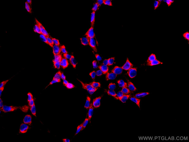 PABPC1,PABP Antibody in Immunocytochemistry (ICC/IF)