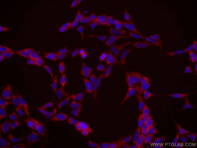 PABPC1,PABP Antibody in Immunocytochemistry (ICC/IF)