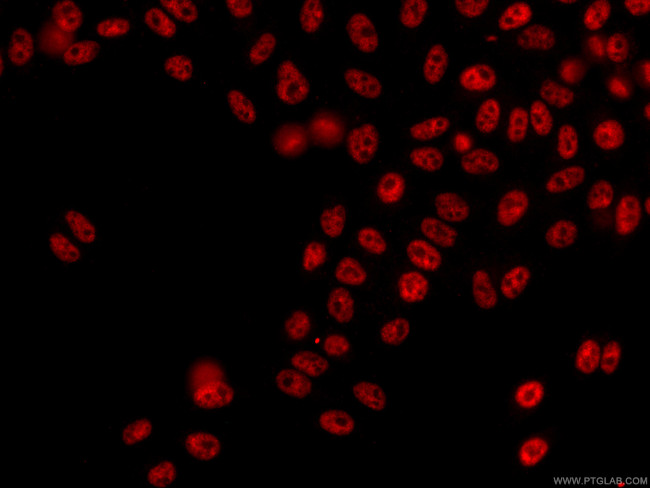 NRF1 Antibody in Immunocytochemistry (ICC/IF)