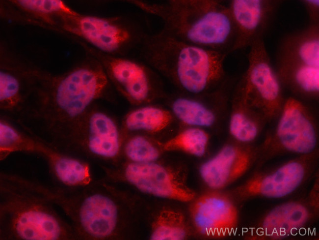 MBNL1 Antibody in Immunocytochemistry (ICC/IF)