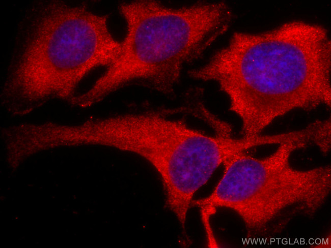 SERPING1/C1 Inactivator Antibody in Immunocytochemistry (ICC/IF)