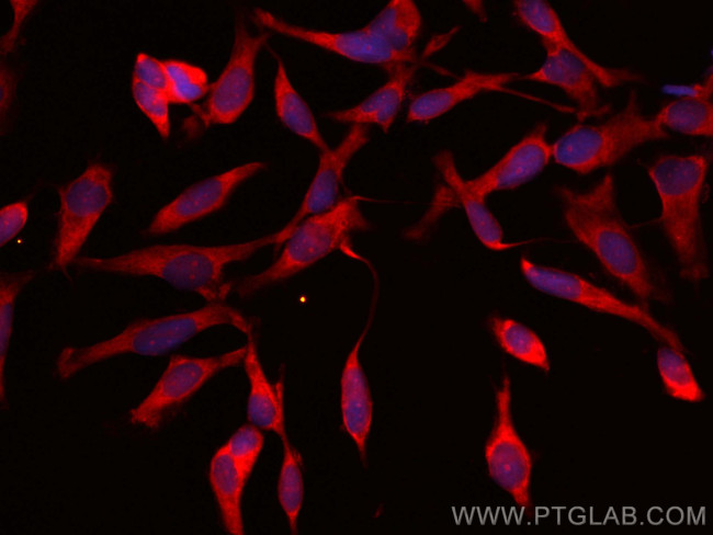 PRMT2 Antibody in Immunocytochemistry (ICC/IF)