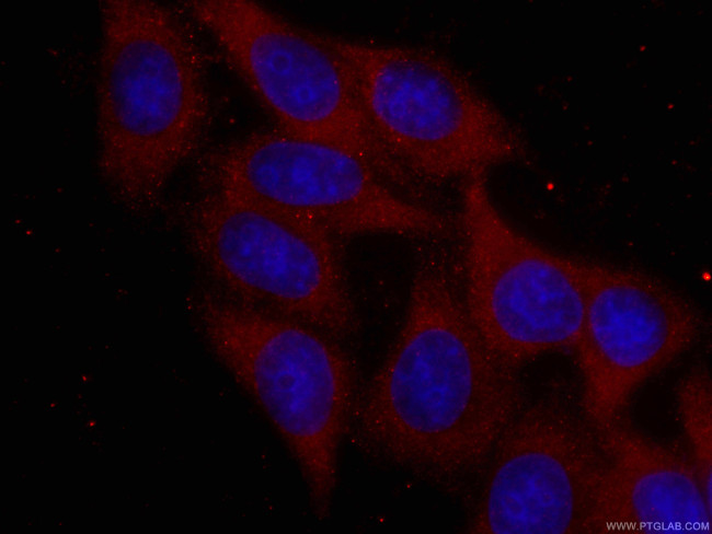 RPS6 Antibody in Immunocytochemistry (ICC/IF)