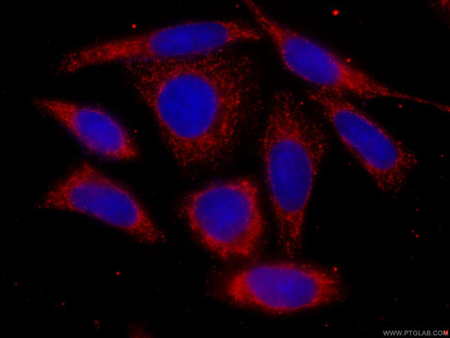 mTOR Antibody in Immunocytochemistry (ICC/IF)