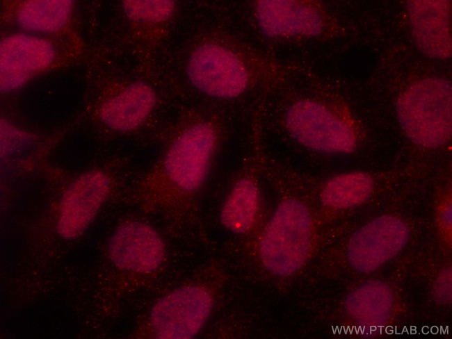 CUL1 Antibody in Immunocytochemistry (ICC/IF)