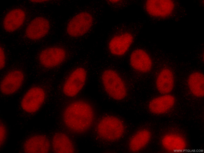 CTBP1 Antibody in Immunocytochemistry (ICC/IF)