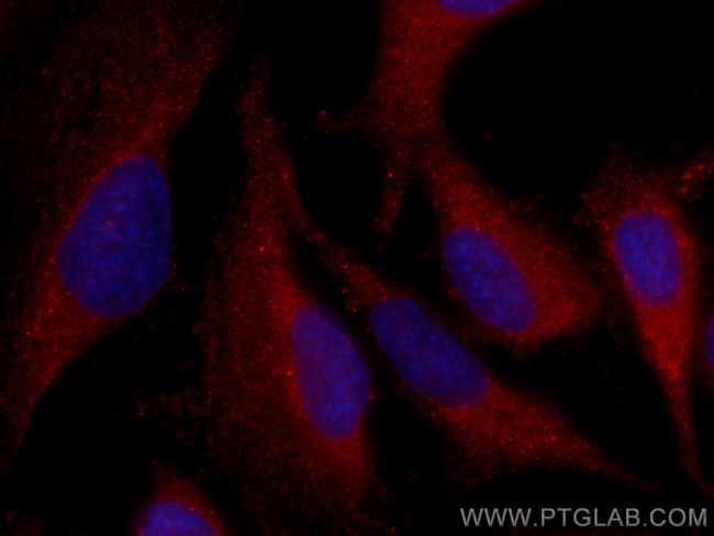 PI3 Kinase p110 Alpha Antibody in Immunocytochemistry (ICC/IF)