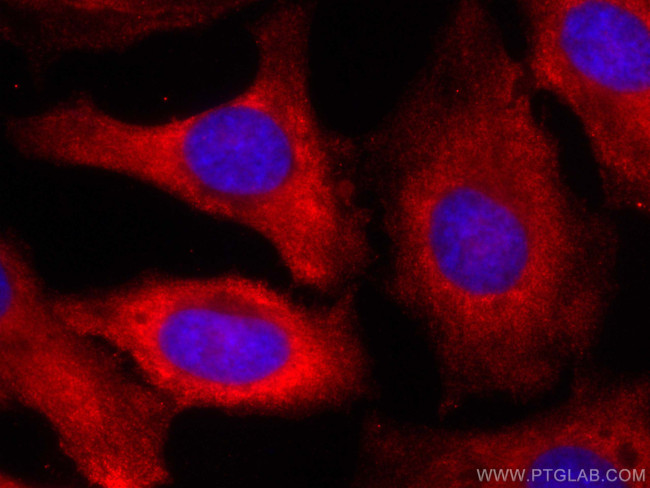 Calpastatin Antibody in Immunocytochemistry (ICC/IF)