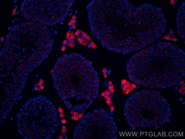 STAR Antibody in Immunohistochemistry (PFA fixed) (IHC (PFA))