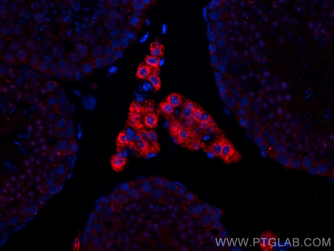 STAR Antibody in Immunohistochemistry (PFA fixed) (IHC (PFA))