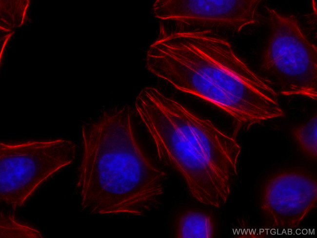 FLNA Antibody in Immunocytochemistry (ICC/IF)