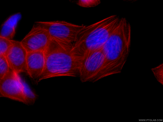 FLNA Antibody in Immunocytochemistry (ICC/IF)