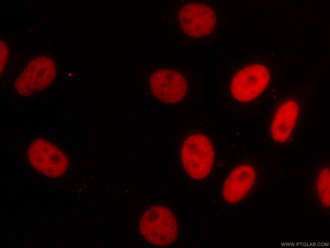 HDAC2 Antibody in Immunocytochemistry (ICC/IF)