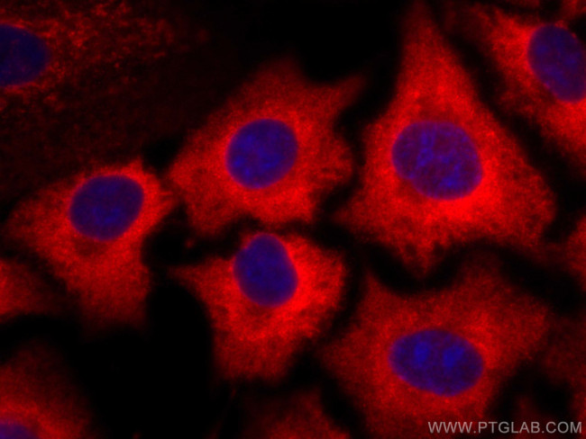 ACLY Antibody in Immunocytochemistry (ICC/IF)