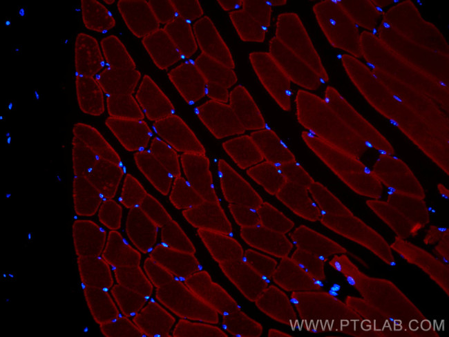 MYH1 Antibody in Immunohistochemistry (PFA fixed) (IHC (PFA))