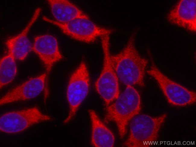 AMPD2 Antibody in Immunocytochemistry (ICC/IF)