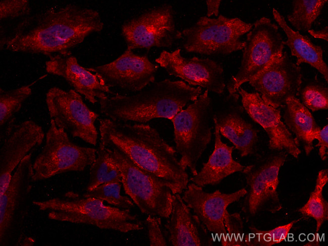 MTH1 Antibody in Immunocytochemistry (ICC/IF)