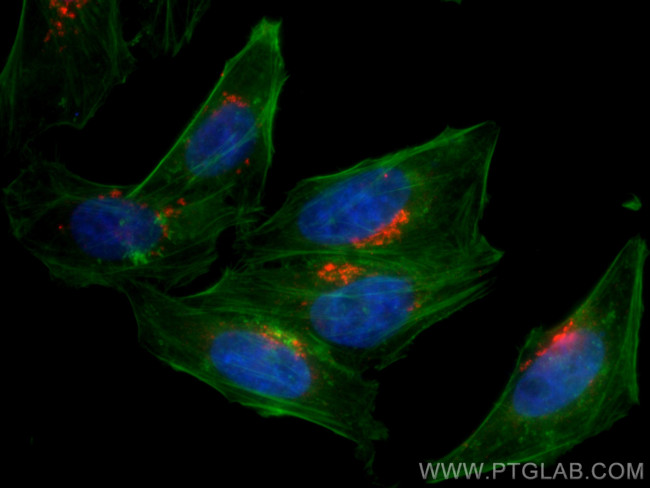 TMF1 Antibody in Immunocytochemistry (ICC/IF)