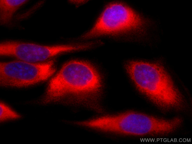 CCT7 Antibody in Immunocytochemistry (ICC/IF)