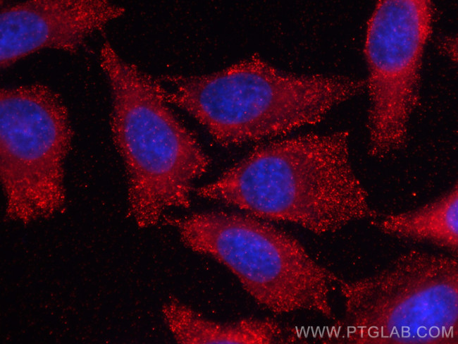 PICALM Antibody in Immunocytochemistry (ICC/IF)